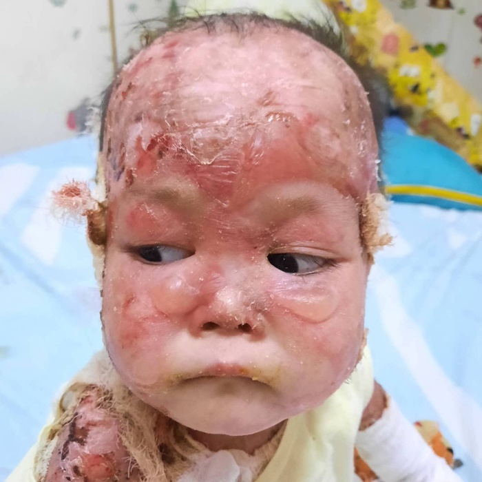 Please Donate to Stop Lily's Severe Pain and Help Save Her Life