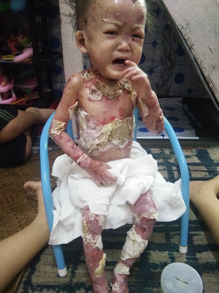 Please Donate to Stop Lily's Severe Pain and Help Save Her Life — photo 3